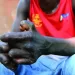 Angola regista mais de 700 casos de lepra em 2022