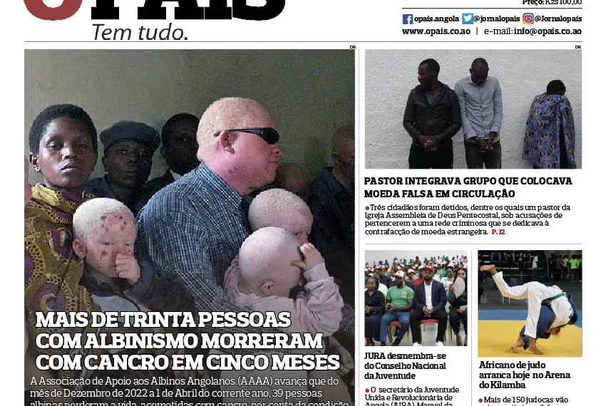 Editorial: Albinismo