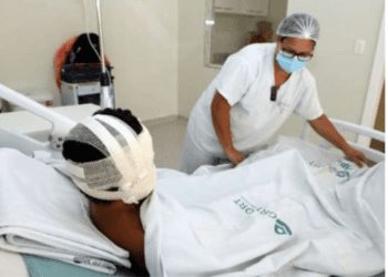 Tia queima o sobrinho por ter comido a papa do bebé