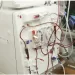 “Doentes com insuficiência renal devem evitar comer banana, ginguba, verduras e peixe”