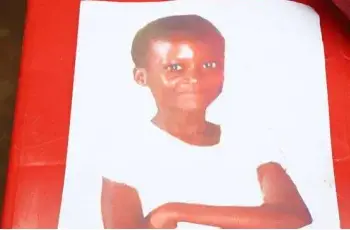 Menina de 12 anos  morre após ser  mordida por um cão