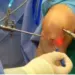 Cirurgia artroscópica carece de recursos humanos e meios em Angola