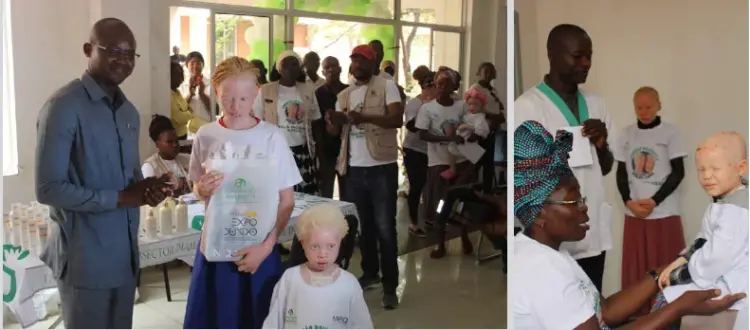 Melba Care se junta à Fundação Brilhante e proporcionam gratuitamente kit de protecção da pele para albinos