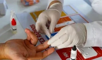 Nova variante do HIV é detectada na Bahia,  no Rio de Janeiro e no Rio Grande do Sul