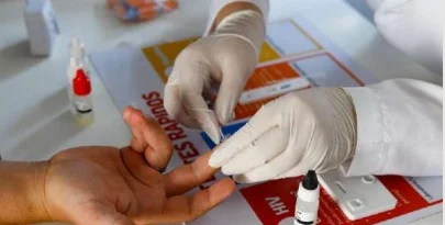 Nova variante do HIV é detectada na Bahia, no Rio de Janeiro e no Rio Grande do Sul