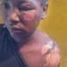 Mãe queima filha por extraviar a peruca no Namibe