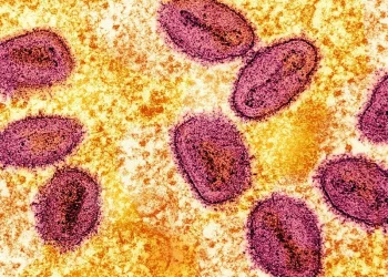 Quase 30 mil casos suspeitos  de mpox em África este ano,  diz a OMS