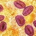 Quase 30 mil casos suspeitos  de mpox em África este ano,  diz a OMS