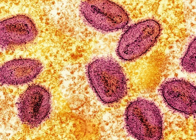Quase 30 mil casos suspeitos  de mpox em África este ano,  diz a OMS