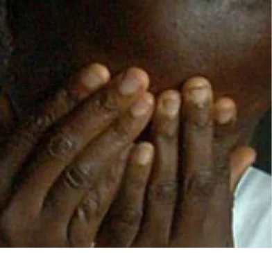 Criança de 10 anos mantida em cárcere privado pela mãe há quatro anos