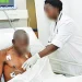 Casos de tuberculose tendem a subir e Bengo regista maior taxa