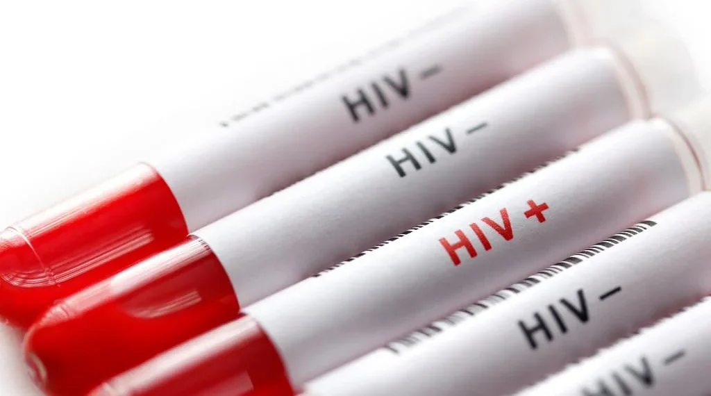 Moçambique quer reduzir incidência do HIV/Sida para menos de metade