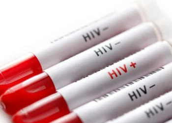 Moçambique quer reduzir incidência  do HIV/Sida para menos de metade