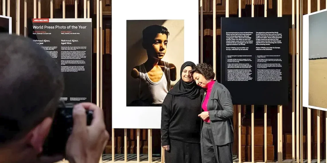 Guerra de Gaza na fotografia do ano  do World Press Photo com menino mutilado