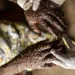 Confirmados mais sete casos de Mpox em Moçambique e 36 suspeitos