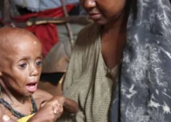 Luanda com duas mil crianças desnutridas por desmame precoce