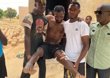 Taxista baleado por agente da Polícia Nacional no Lubango clama por apoio para sustentar a família