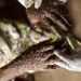 Moçambique com 89 casos de mpox em três meses
