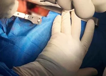 Hospital do Lubango realiza com êxito primeira cirurgia à coluna vertebral