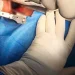 Hospital do Lubango realiza com êxito primeira cirurgia à coluna vertebral