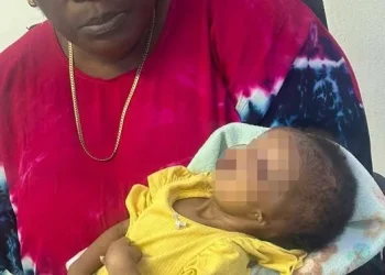 Criança de três meses nasce sem olhos, ouvidos e ânus em Cabinda