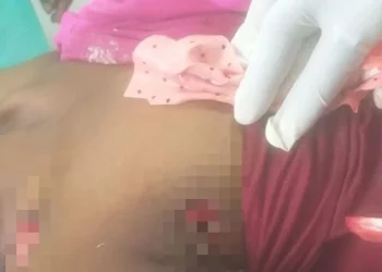 Mulher de 53 anos morre após ser atingida por disparos de arma de fogo no Tunga-Ngó