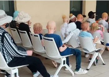Mais de 100 pessoas albinas recebem rastreio de cancro da pele em Viana