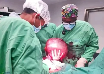 Paciente com tumor de 11,3 quilos operada no Hospital Geral do Cuanza-Norte
