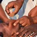 Cubango prevê imunizar cerca de 150 mil crianças na campanha de vacinação contra a poliomielite