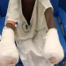 Pai queima mãos dos filhos por suposto furto de 100 kwanzas no Zango 3