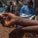 Cabinda concentra 200 dos 289 casos de Mpox registados em Angola