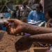 País regista dois novos casos de Mpox e três altas médicas nas últimas 24 horas