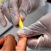 Mais de 2.900 pessoas testam reactivo para Hepatite B em campanha nacional