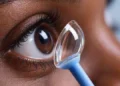 Centrooptico adapta lentes especiais para pacientes com problemas na córnea
